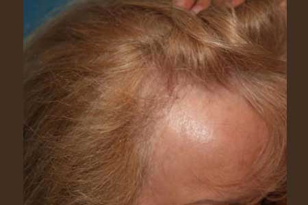 Women’s Hair