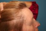 Women’s Hair