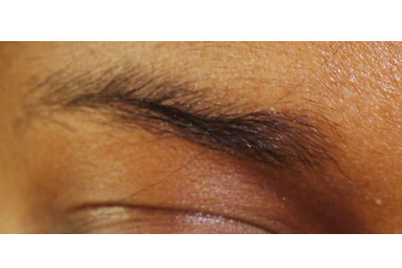 Facial and Eyebrow