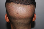 Post-Op Gallery
