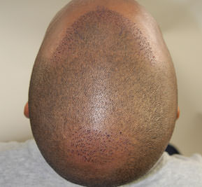 Post-Op Gallery