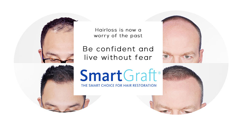 Hair loss can be a worry of the past thanks to SmartGraft. The SmartGraft hair transplantation system provides some of the most natural-looking results available. When it comes to hair transplant surgery, SmartGraft is the way to go. SmartGraft - Be Confident